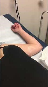 NEXPLANON implant birth control