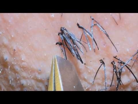 Plucking facial hair 1552 顎髭抜き