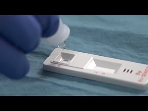 Descubre el Test Rápido de Antígeno NASOFARINGEO para detectar infección por COVID19 en 8 minutos.