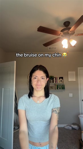 make a TikTok or go see a doctor clearly the options were weighed | chin thing