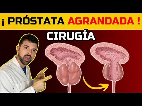 Cirugía RTU de Próstata: Beneficios, Riesgos y Recuperación Explicados