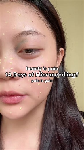 14 days of microneedling using Mary&May spicule Retinol @Mary&May Official #marynmaypopchallenge #marynmay #pdrn #spicule #kbeauty