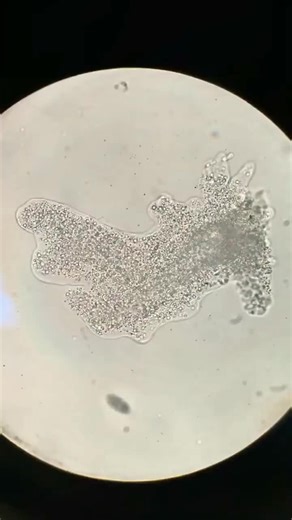 Amoeba using cytoplasmic streaming to move around. Video is sped up 10x. #fyp #science #teachersoftiktok
