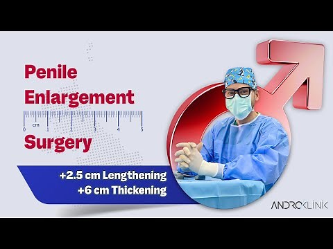 Penile Enlargement Surgery (+2.5 cm Lengthening, +6 cm thickening) - Dr. Evren ISIK