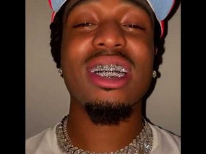 Quavo Shows Off New Teeth