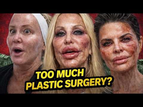 Plastic Surgery Then and Now 2026: You Won’t Believe What Happened to These Real Housewives Faces
