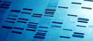 遺伝子検査に協力したら謝礼…アメリカで新手の詐欺が流行ってる