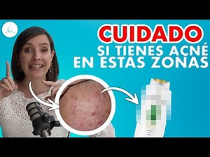 🔴 What does acne mean on every part of your face? @drapilarochoa - Dermatologist