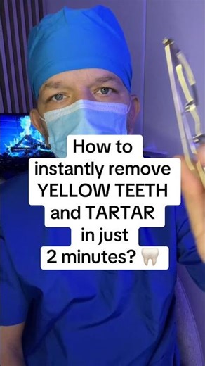 How to Instantly Remove Yellow Teeth and Tartar at Home — Fast Method Explained in 2 Minutes