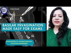 Basilar Invagination Made EASY for Exams#mri #neuroradiology #radiologyresident