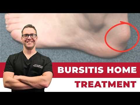Heel Bursitis & Achilles Tendon Bursitis [Best HOME Treatment!]