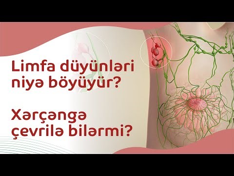 Limfa düyünləri niyə böyüyür? Xərçəngə çevrilə bilərmi?