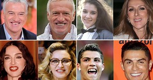 Céline Dion, Didier Deschamps, Madonna... découvrez ces stars qui ont fait refaire leurs dents - PHOTOS