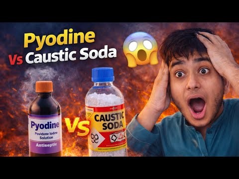 Pyodine Vs Caustic Soda 🔥 | Dangerous Chemical Reaction Experiment!|My Personal Lab