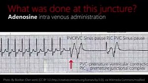 Watch to learn this Rhythm | Medical GIF