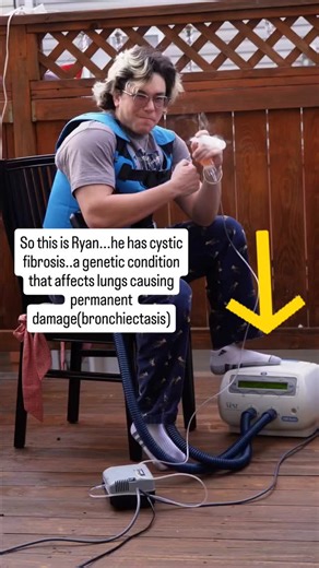 Dr.Divya Grace M.D PULMONOLOGIST on Instagram: "The airway clearance vest is a physiotherapy tool that uses vibrations to clear mucus from the lungs. It helps people with Cystic Fibrosis, Bronchiectasis, and other chronic lung conditions breathe better and reduce infection risk. A simple therapy with life-changing benefits! 🔹 How It Works Vibrates the chest wall (HFCWO technology) Loosens thick mucus in the lungs Makes it easier to cough out 🔹 Benefits Improves breathing capacity Reduces lung
