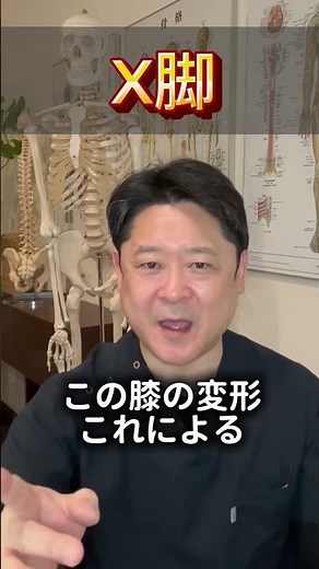 X脚が！実は！【変形性膝関節症】を悪化させる原因です！