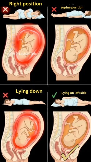 ​Best Pregnancy Sleeping Position 🤰Pregnancy Guide