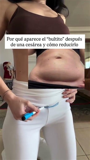 Muchas mamás después de una cesárea notan algo que les preocupa…