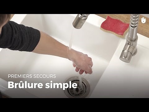 First Aid: Simple Burn | First Aid