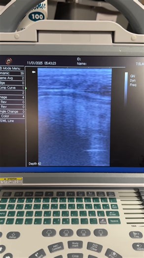Ultrasounding day Here is a Just a few girls! Some are pretty close. One of these females has only locked three times!!