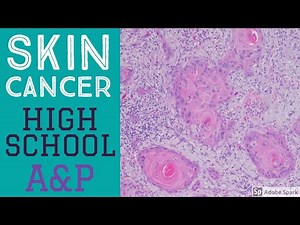 What does skin cancer look like under the microscope? Skin cancer explained in simple terms