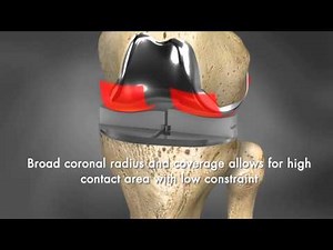 iTotal® G2 iFit® Technology Animation