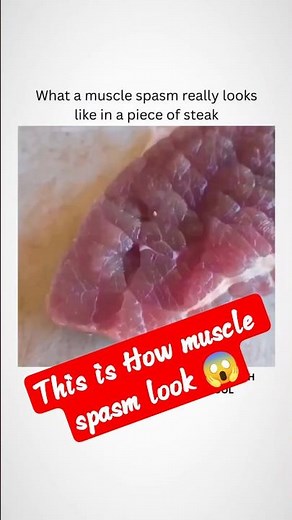 this is how Muscle spasm looks like 😱 #shortsviral #medical #science #sciencefacts