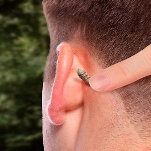 108K views · 459 reactions | What's the worst that can happen from these insects stings? #WhatIf | What If | Facebook