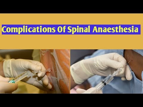 Spinal Anaesthesia||Complications Of Spinal Anesthesia||#Spinal Anesthesia Complications