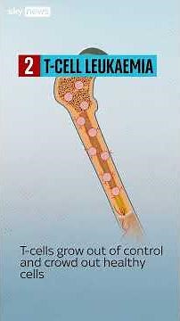 Breakthrough in treating 'incurable' blood cancer