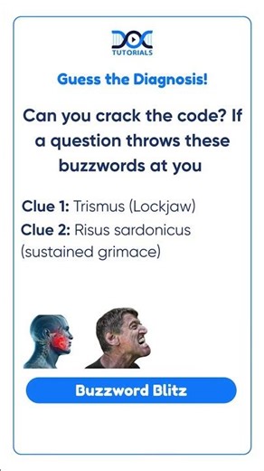 Cracking the Diagnosis: Trismus, Risus Sardonicus, and Opisthotonos | Medical Buzzword Blitz