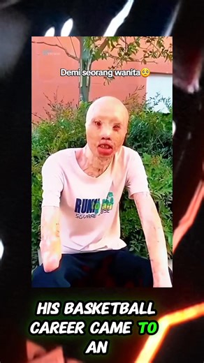 The Tragic Fall of South Korea’s Rising Basketball Star He Risked His Life for Love… But the Fire Took His Dreams Away #truestory #DidYouKnow #inspirational #fblifestyle #basketball | Facts By AN