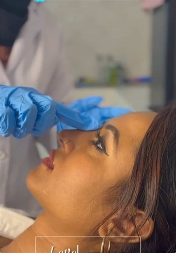 Expert Lip Enhancement at The Face Clinic