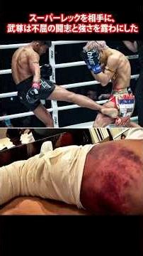 スーパーレックを相手に、武尊は不屈の闘志と強さを露わにした | 彼は松葉杖で会場を後にした TAKERU