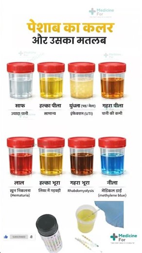 Urine Colour Meaning Explained | पेशाब के रंग से बीमारी पहचानें