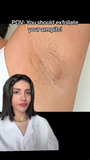 How to Prevent Razor Bumps on Your Armpits