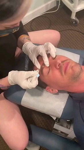 Pimple Popping on Instagram: "Omg 🙄🙄🙄 - - #pimplepoppingvideos #blackheadsextraction #whiteheadsextraction #cystremoval #zit #acne #extraction #oddlysatisfying"
