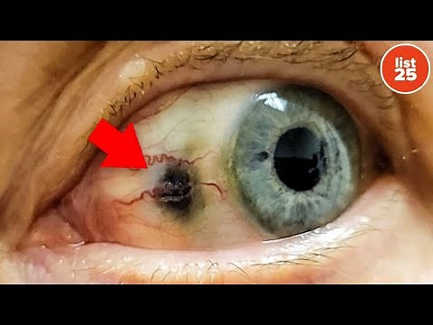 100 Bizarre Facts About Diseases and the Human Body