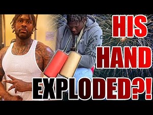 4xtra BLOWS UP HIS HAND Firework Accident – Full Story & Aftermath