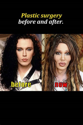 Celebrity Plastic Surgery Disasters