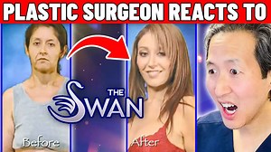 Doctor Reacts to The Swan, TV’s Most Controversial Plastic Surgery Show