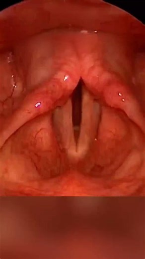 AUMA CLARIFY NOW on Instagram: "How Your Body Builds a Voice From Scratch"