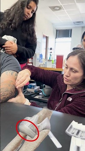 How to Fix Elbow Pain from Weight Lifting with Dry Needling