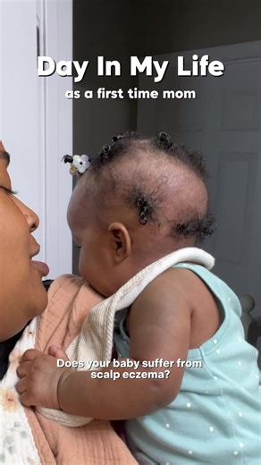 Does your baby suffer from scalp eczema? Well that USED to be me in the Newborn Trenches™. But ever since I started using @ReaganSanai 6 months ago, my babies hair been ✨FLOURISHING✨ in the Toddler Trenches™ 🙌🏽✨ I've literally been using Reagan Sanai's products for six months consistently and My Baby's hair has completely transformed 😱😍. These are the only products I put on my babies hair and I 1000/10 recommend this brand to anyone that's struggling with scalp eczema, dry scalp, or sensitiv