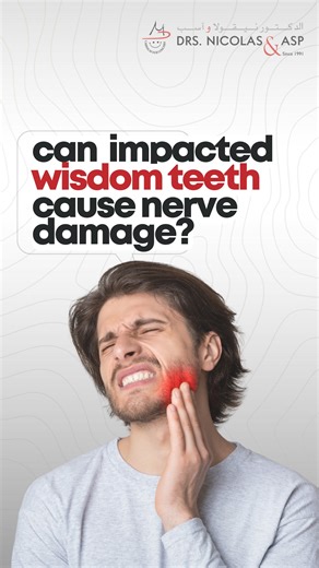 Can impacted wisdom teeth cause nerve damage? In this video, Dr. Suzan explains how impacted wisdom teeth can affect nearby nerves, the symptoms to watch for, and when early intervention is essential. | Drs. Nicolas & Asp Centers