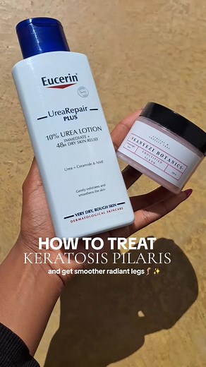 Effective Keratosis Pilaris Treatment for Smooth, Hydrated Legs