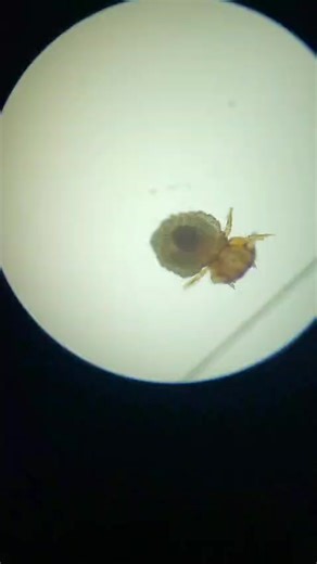 Trichodectes Canis o mejor conocido piojo masticados del perro. Desmontrándonos un bailecito 🫢 #piojo #veterinaria #laboratorioclínico #canis