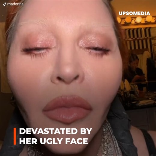 For decades she shattered her critics, but now Madonna is suffering from ridicule of her strange face. Willing to undergo any treatment or operation, the artist is desperate, begging for help after years of excesses that quickly deteriorated her. | Golden Years