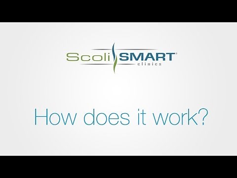 The ScoliSMART® Approach